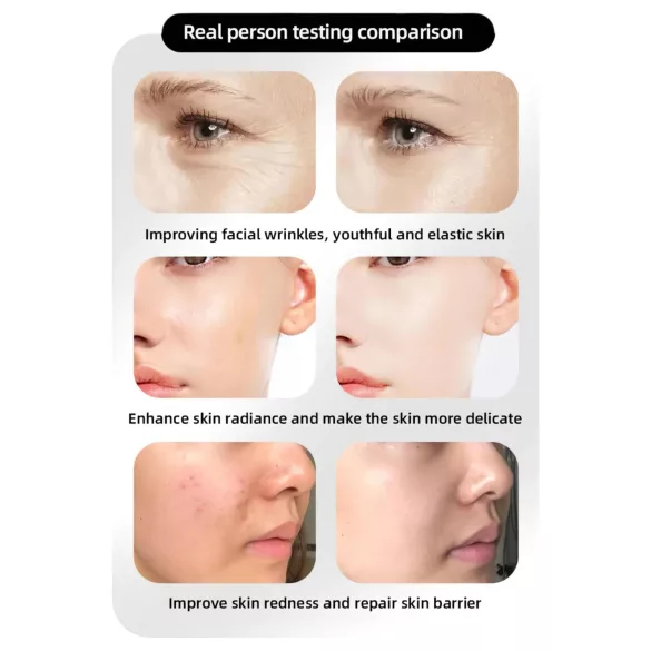 Masque LED rajeunissant Photon Rejuvenation